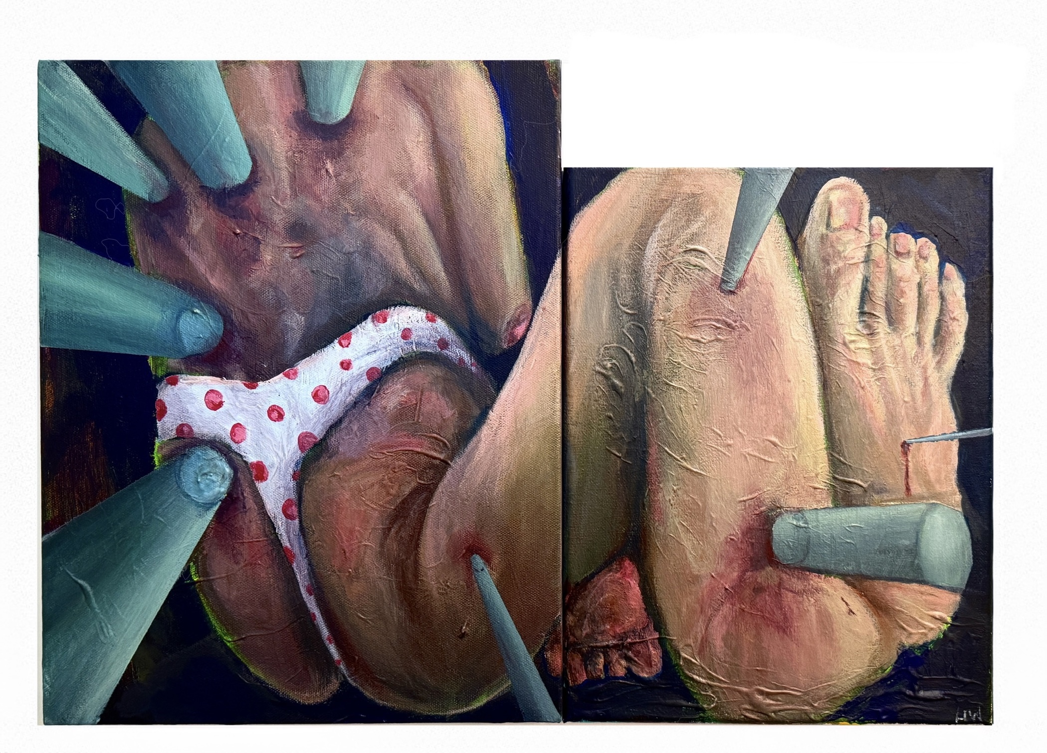Boy in Thong (Wounds)